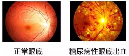 “爱眼护眼 视在必行”——福州眼科医院将举行糖尿病眼底病公益讲座1.png