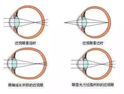 儿童正常眼位图片图片