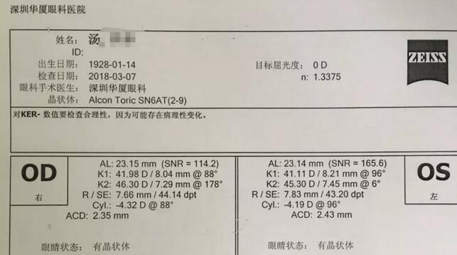 3月12日下午，已经90高龄的离休东江纵队老兵汤爷爷，在深圳华厦眼科医院检查之后，白内障专科邢宝刚主任为其实施左眼白内障超声乳化摘除，联合散光人工晶体植入术。2.jpg