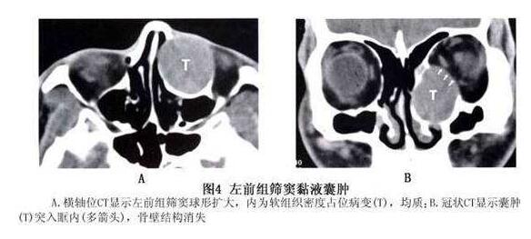 4月7-8日，天津医科大学眼科医院副院长、天津医科大学眼视光学院副院长、中华眼科学会委员、眼整形、眼眶病学组副组长孙丰源教授将莅临福州眼科医院2.jpg