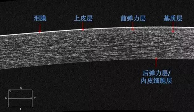 华厦眼科课堂：后节频域OCT前节模块的运用2.jpg