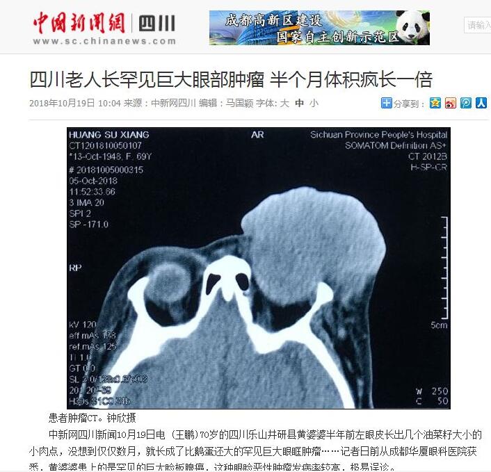 媒体看华厦之成都华厦眼科医院2018年新闻媒体报道集锦13.jpg