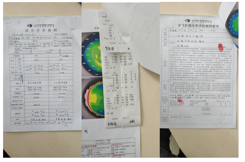 兰州全飞秒近视手术术前检查单