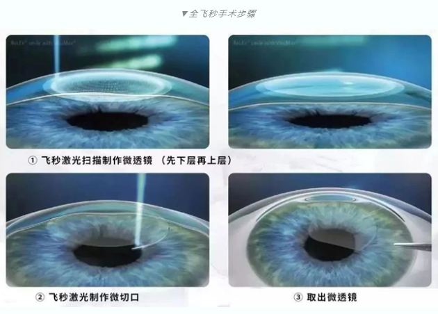 7月26日来深圳华厦眼科医院参与暑期摘镜季活动就可以有机会参与抽奖免单手术！2.png